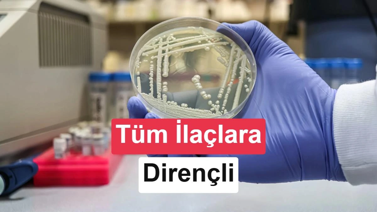 Laboratuvarda eldivenli bir elin tuttuğu mantar kültürü bulunan petri kabı
